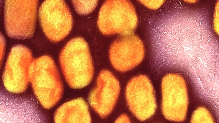 Dezenformasyonla Mücadele Merkezi’nden Türkiye’de ‘maymun çiçeği’ açıklaması: ‘Tüm önlemler alındı’