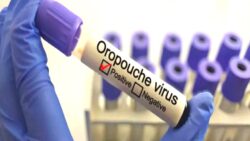 Oropouche virüsü nedir ve nasıl tedavi edilir?