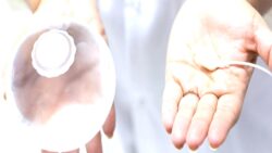 Mide balonunda yasak kalktı