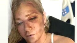 Jeffrey Epstein mağduru Virginia Giuffre’ye otobüs çarptı: ‘4 gün ömrüm kaldı’