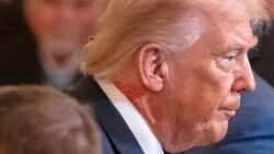 Trump’ın boynundaki kızarıklık gündem olmuştu: Beyaz Saray’dan ilk açıklama