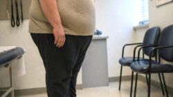 Yeni araştırma: Obezite Alzheimer riskini artırabilir